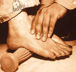 Basis of Indian Naturopathy